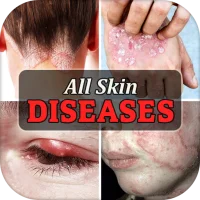 All Skin Diseases & Treatment